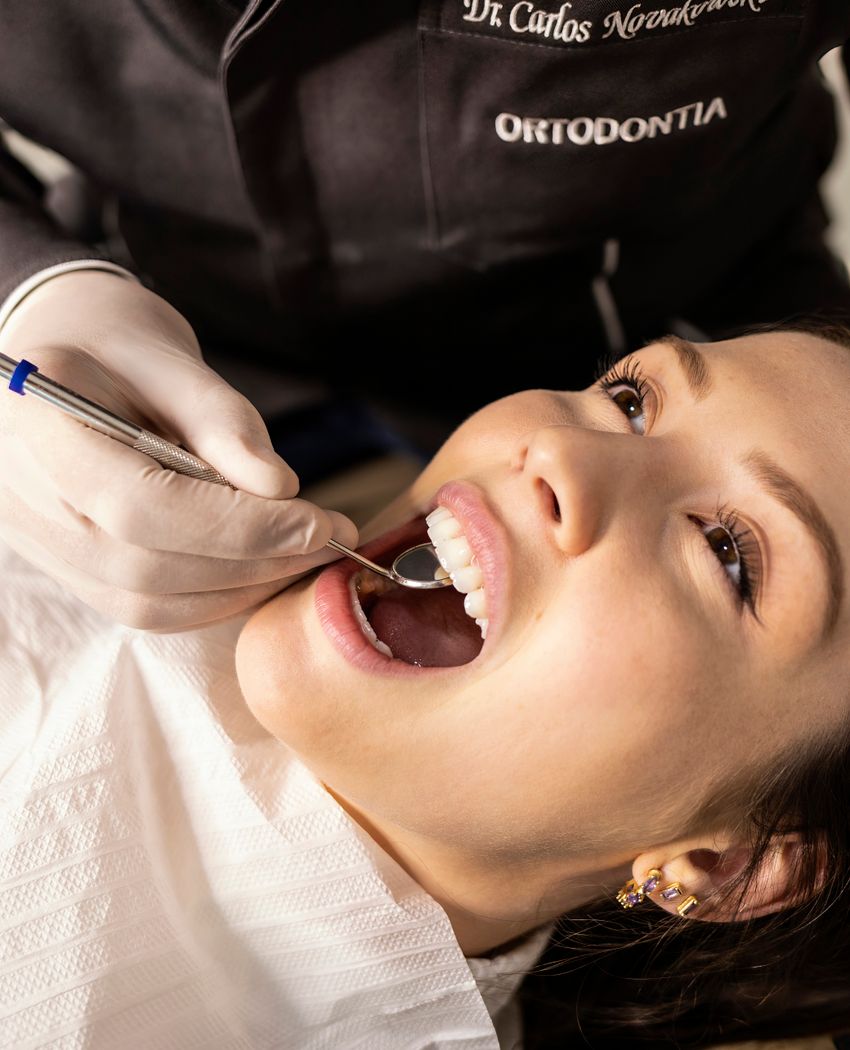 Diastema (diş arası) kapatma