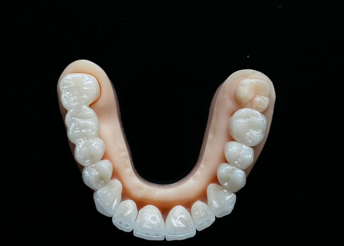 Porselen Lamina
